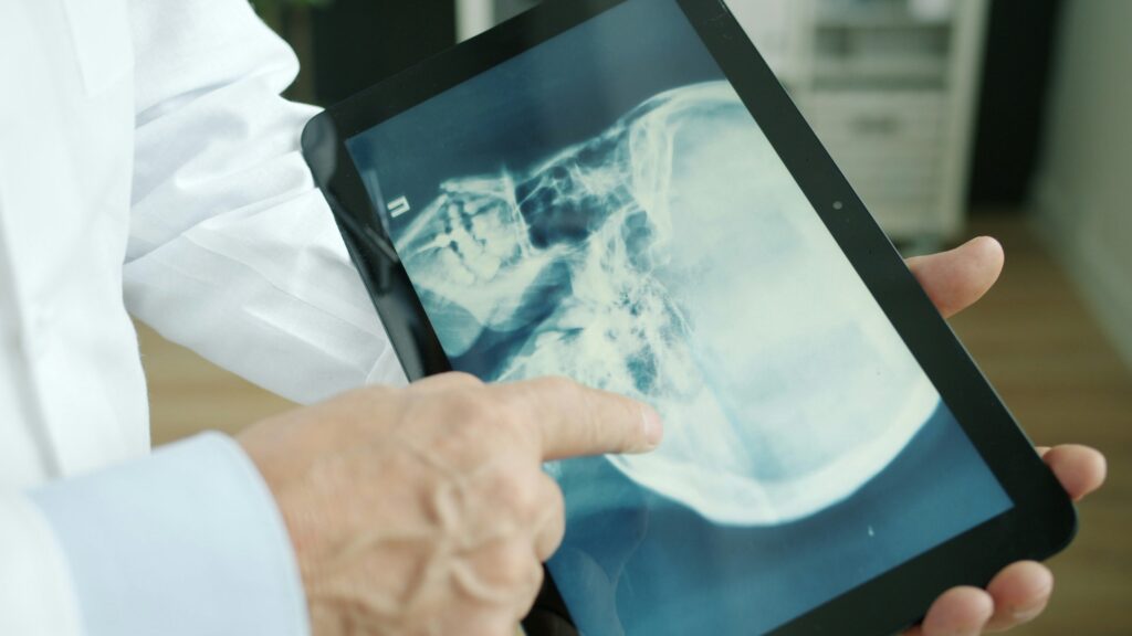An x-ray is displayed on a tablet.